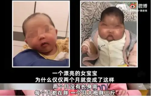 激素面霜卷土从来长期使用会变大头娃娃
